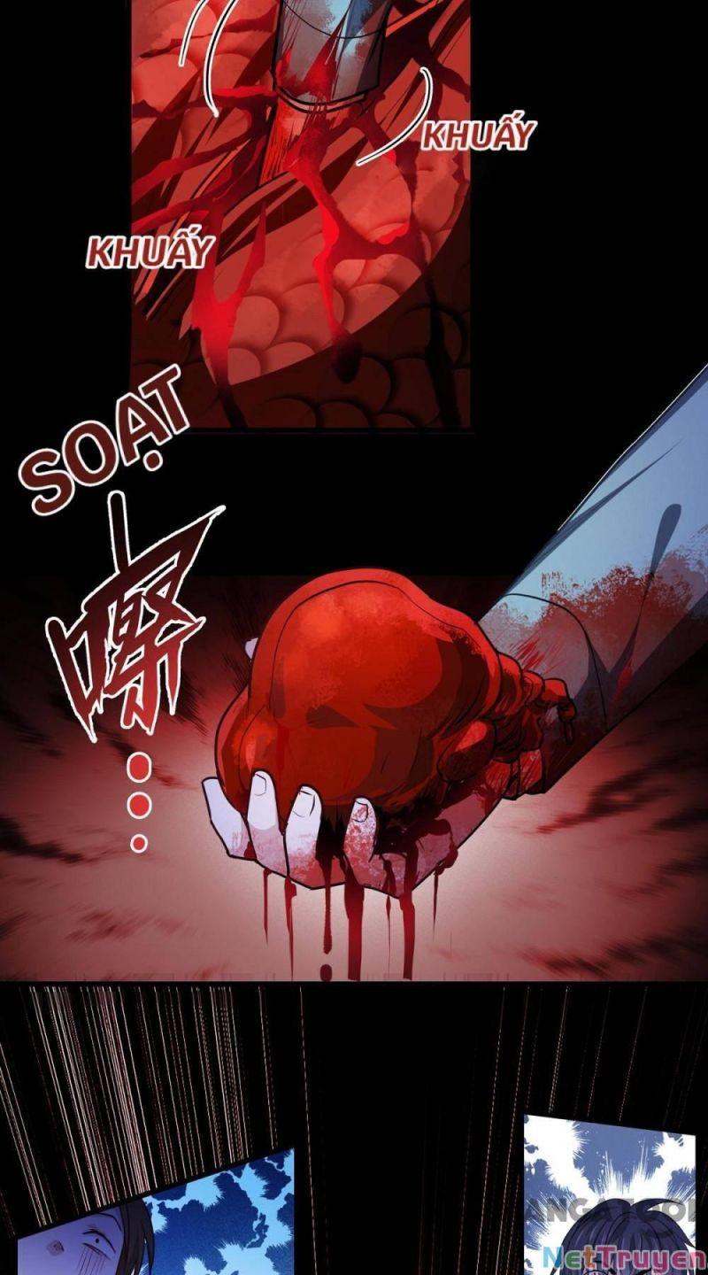 Bị Cắn Thành Vương Giả Chapter 11 - Trang 2