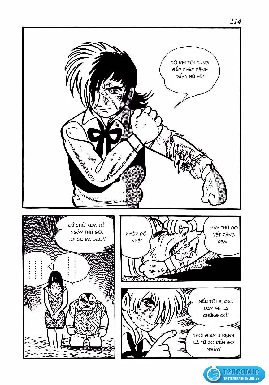 Black Jack Chapter 175 - Trang 2