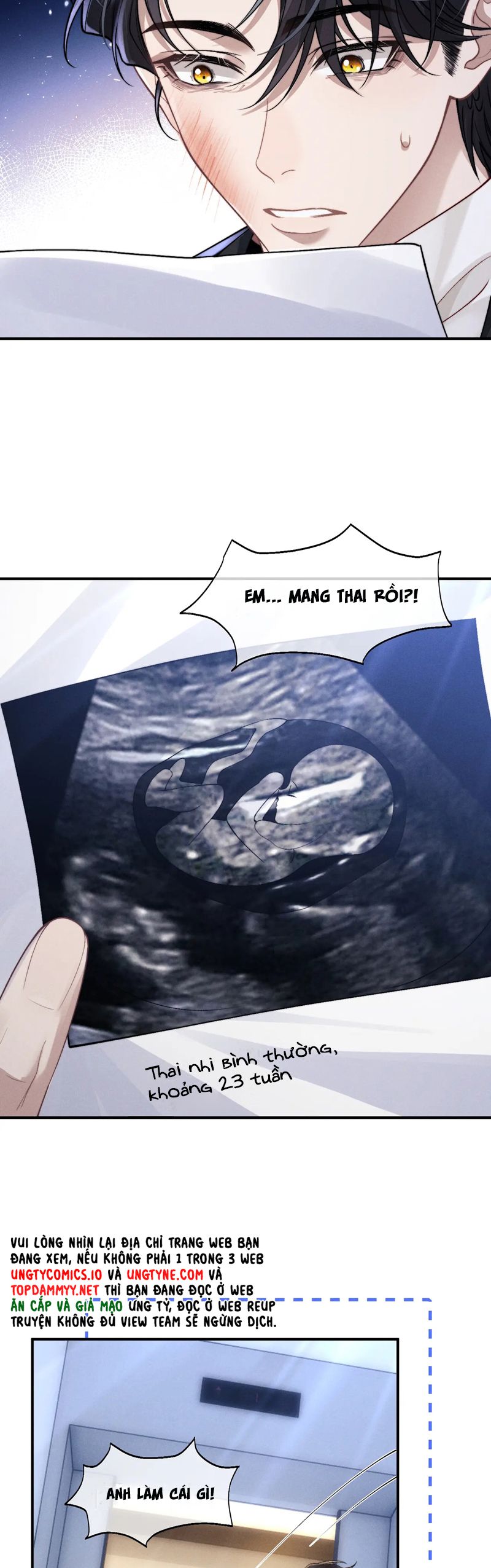 Chấp Sự Thỏ Cụp Tai Chapter 130 - Trang 2