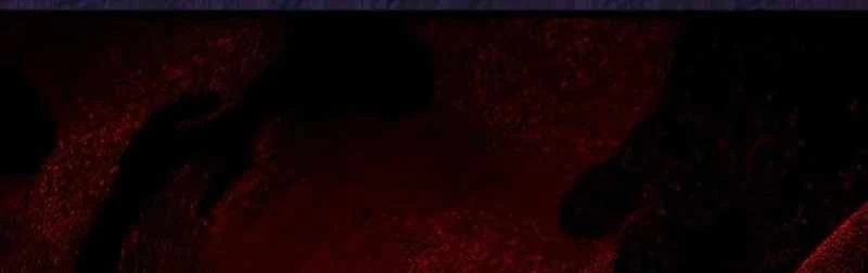 Công Chúa Hắc Viêm Lv.99 Chapter 2 - Trang 2
