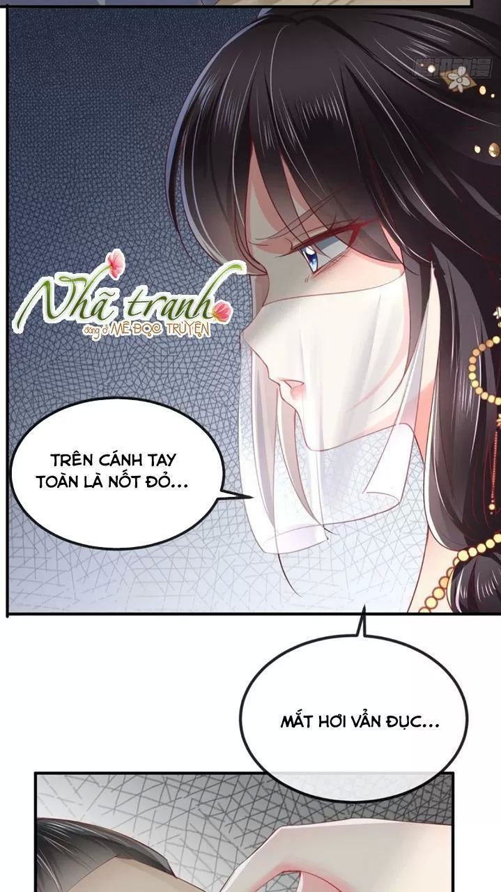 Độc Phi Ngu Ngốc Không Thể Chọc Chapter 105 - Trang 2