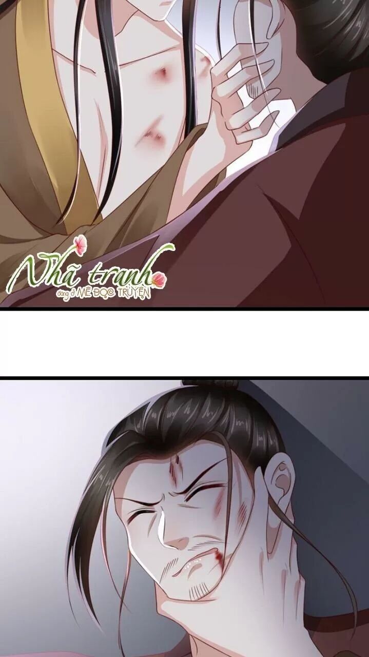 Độc Phi Ngu Ngốc Không Thể Chọc Chapter 117 - Trang 2