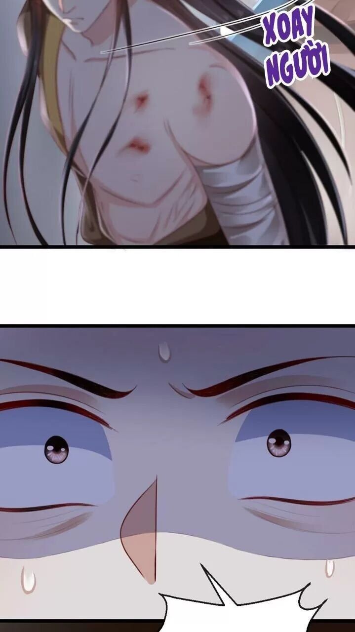 Độc Phi Ngu Ngốc Không Thể Chọc Chapter 117 - Trang 2