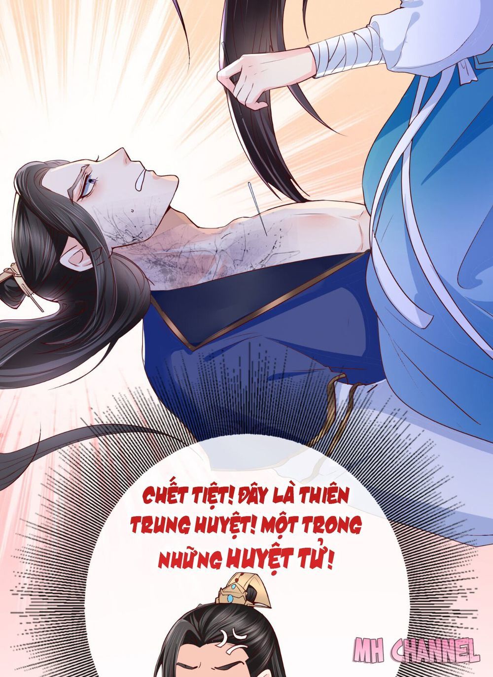 Độc Phi Ngu Ngốc Không Thể Chọc Chapter 6 - Trang 2