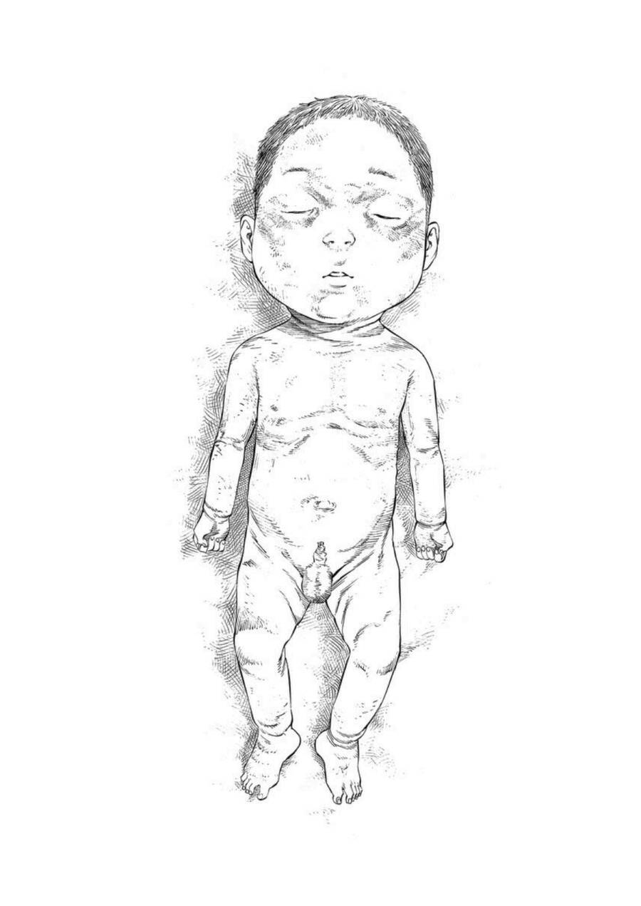 Give My Regards To Black Jack Chapter 33 - Trang 2