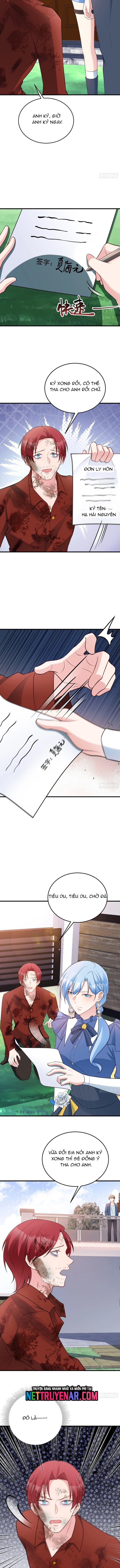 Hệ Thống Siêu Cấp Trà Xanh Chapter 88 - Trang 2