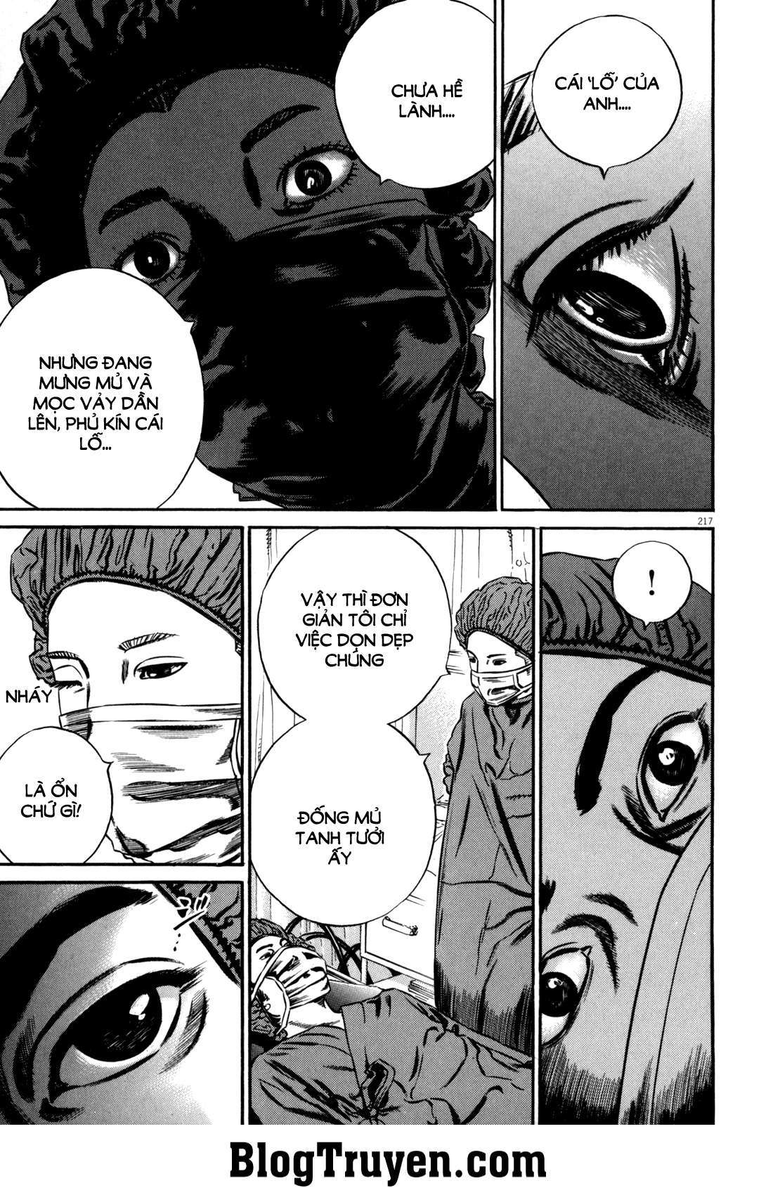 Homunculus Chapter 101 - Trang 2