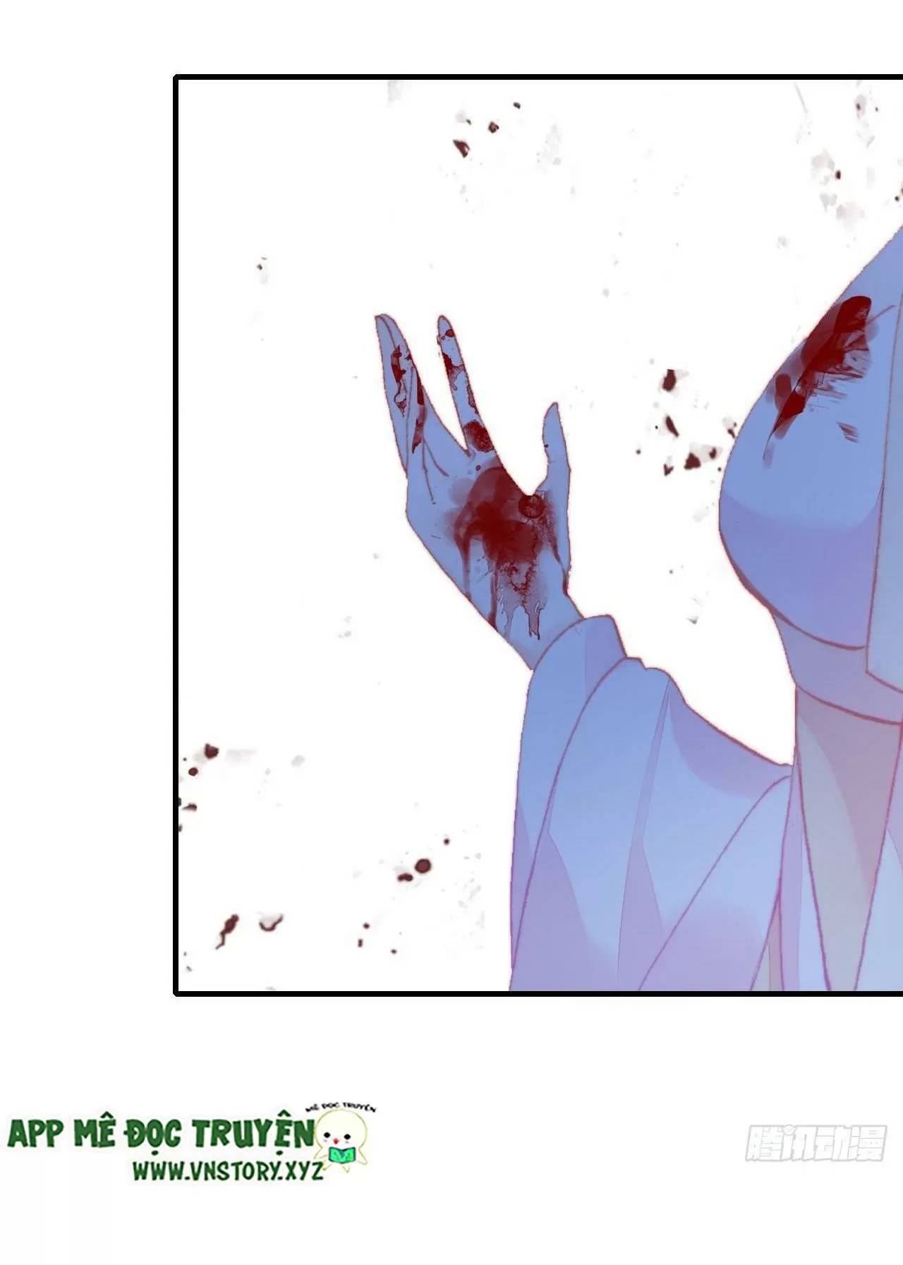 Lại Bị Bệnh Chiều Chuộng Quấn Lấy Chapter 75 - Trang 2