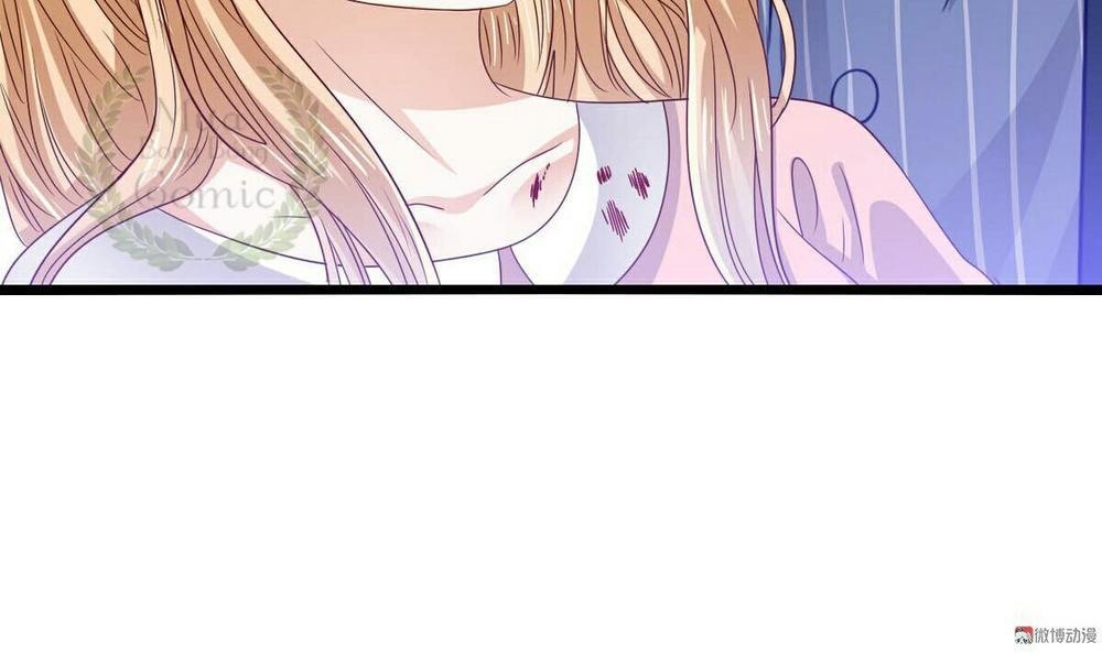 Lăng Thiếu! Nhẹ Một Chút, Đau Chapter 11 - Trang 2