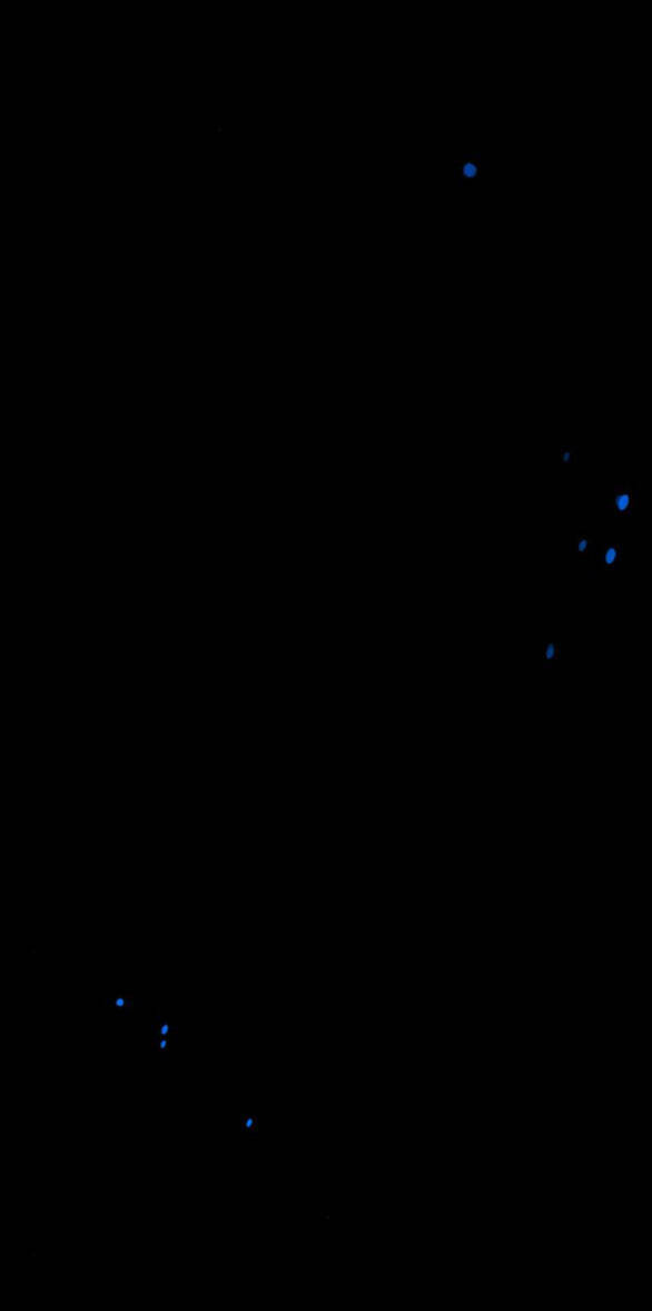 Serena Chapter 31.2 - Trang 2