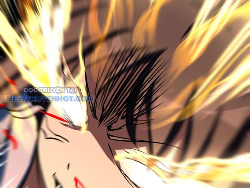 Tinh Thông Pháp Thuật Hồi Phục, Ta Đột Nhiên Vô Địch Chapter 11 - Trang 2