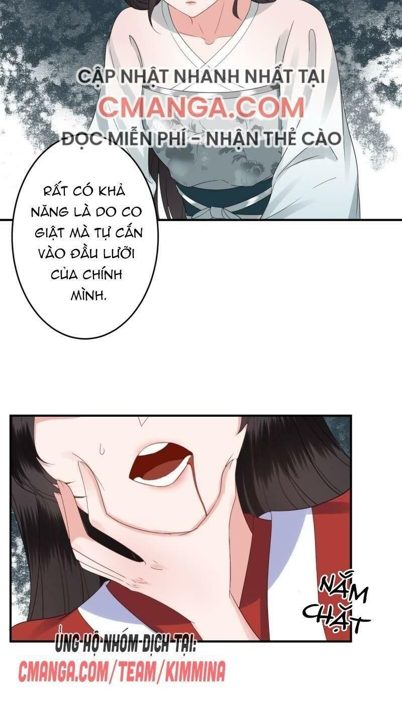 Vương Gia Kiêu Ngạo Quá Khó Cua Chapter 76 - Trang 2