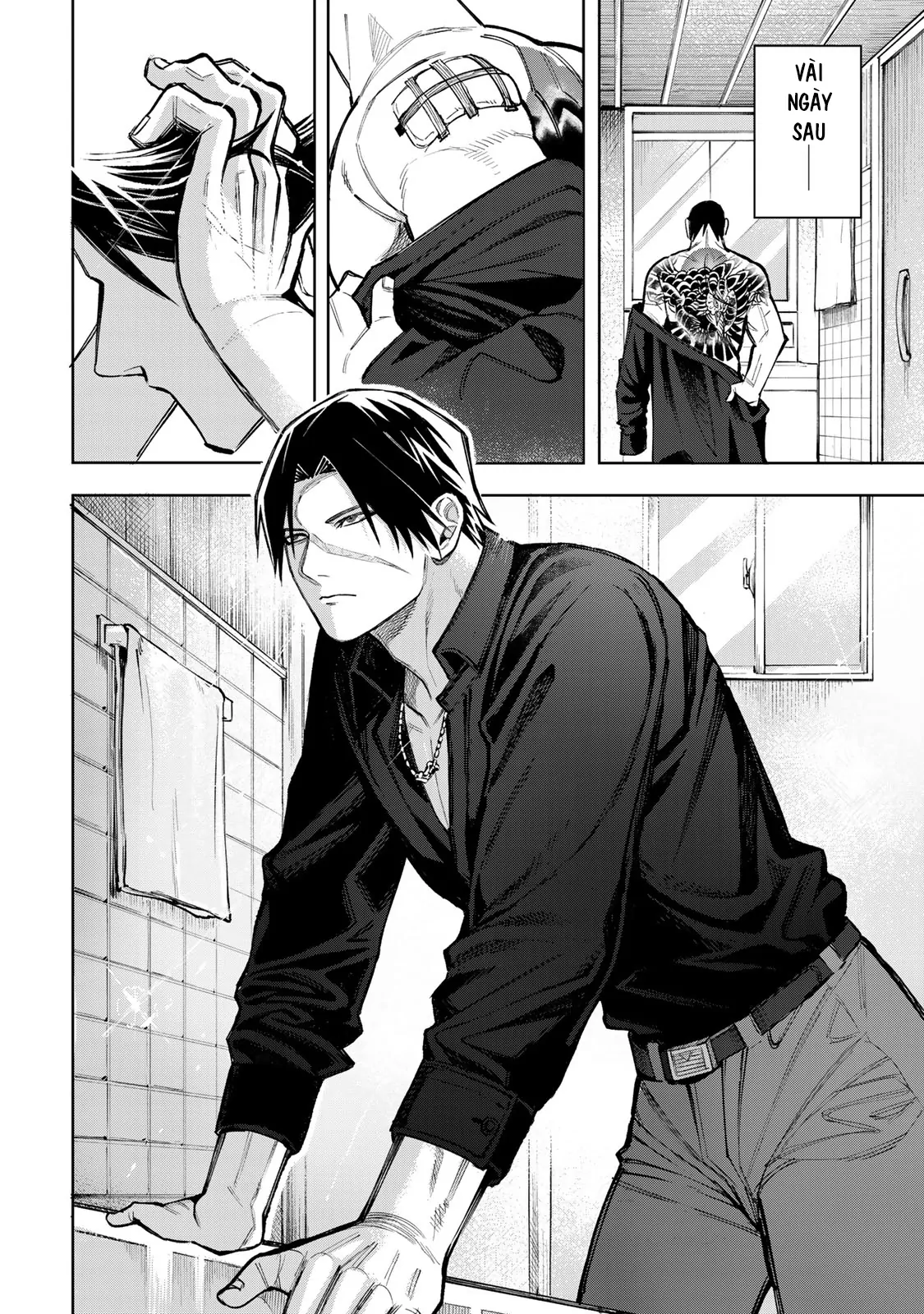 Wound & Bandage Chapter 3 - Trang 2